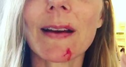 VIDEO Slavna pjevačica objavila snimku na kojoj je krvava i izgrebana: "Ne volim je više"