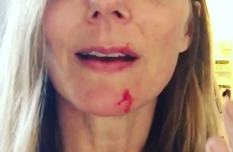 VIDEO Slavna pjevačica objavila snimku na kojoj je krvava i izgrebana: "Ne volim je više"
