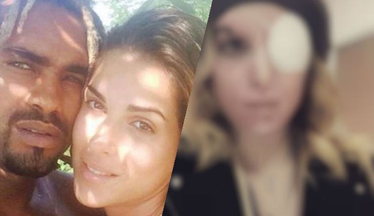 Manekenka objavila prvi selfie nakon što joj je bivši dečko kiselinom unakazio lice