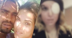 Manekenka objavila prvi selfie nakon što joj je bivši dečko kiselinom unakazio lice