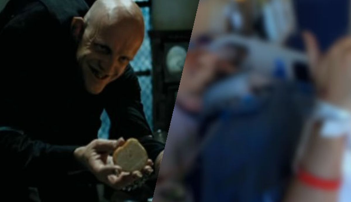 Glumac iz "Harryja Pottera" doživio tešku prometnu nesreću, fanove šokirala fotografija iz bolnice