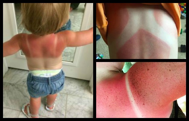 Tvrtka Jessica Albe na udaru kritika: "Užasan proizvod! Moje dvogodišnje dijete izgorjelo je na suncu"