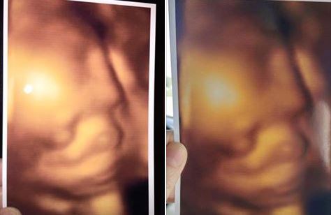 Kakva sramota - mamama su davali totalno identične slike s 3D ultrazvuka