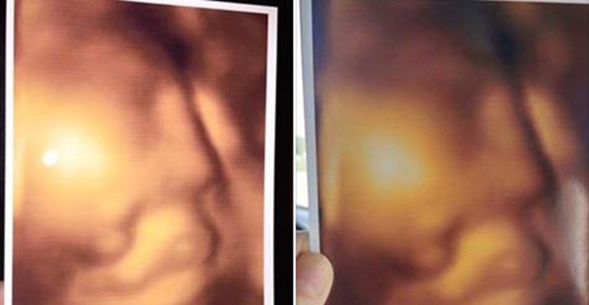 Kakva sramota - mamama su davali totalno identične slike s 3D ultrazvuka