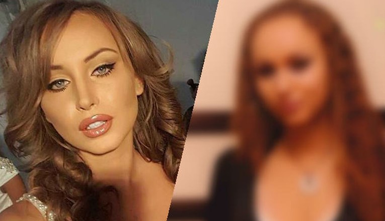 FOTO Nova miss Srbije sad je seks bomba, no prije nekoliko godina nije izgledala ovako