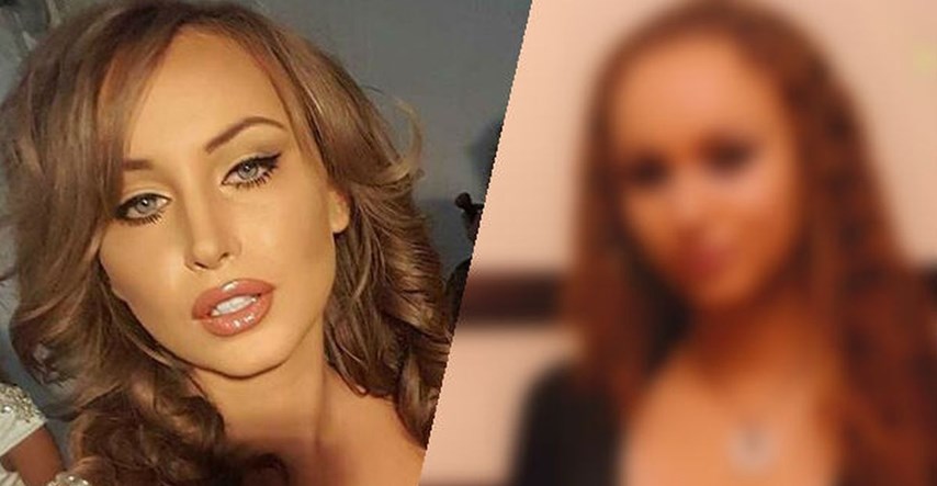 FOTO Nova miss Srbije sad je seks bomba, no prije nekoliko godina nije izgledala ovako