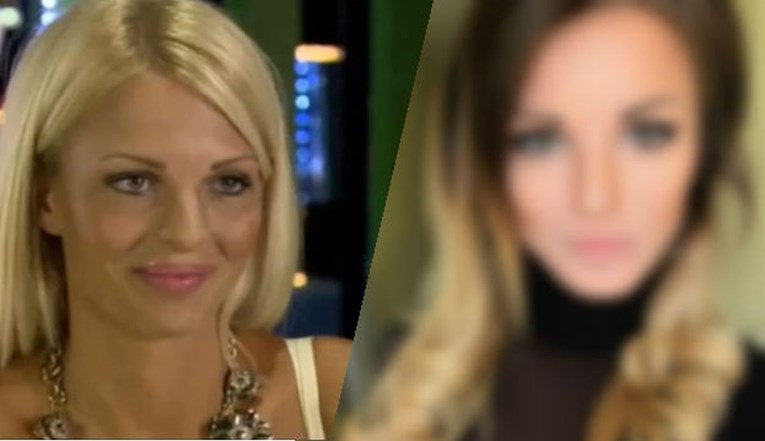 FOTO Seksi Ivona iz Big Brothera posjetila je plastičnog kirurga i drastično promijenila izgled