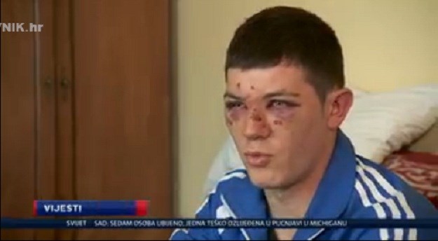 Ispovijest pretučenog mladića za srpske medije: Krvnički su me mlatili i vikali "nije ti ovo Srbija"