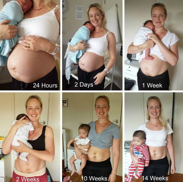 Bez cenzure i uljepšavanja: Objavila fotke nakon poroda kako bi poslala važnu poruku