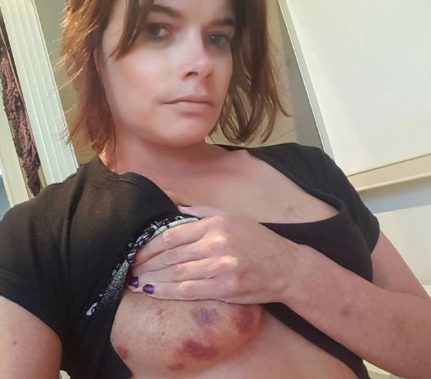 Žrtva silovanja objavila fotografije: "Želim pokazati koliko je sjeban naš pravni sustav"