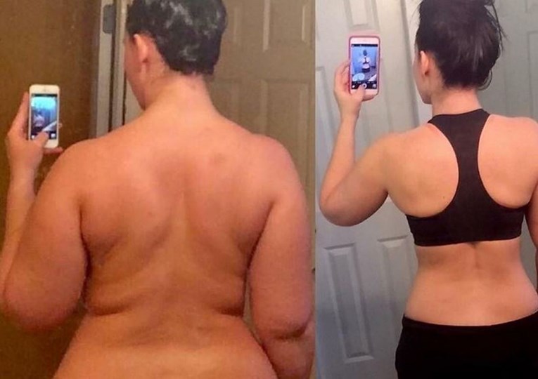 Nakon što je shvatila pravi uzrok svoje pretilosti, izgubila je 35 kilograma bez ikakve dijete
