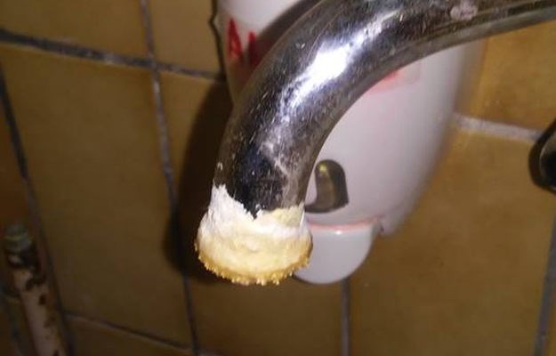 Pogledajte na što liče hrvatske bolnice