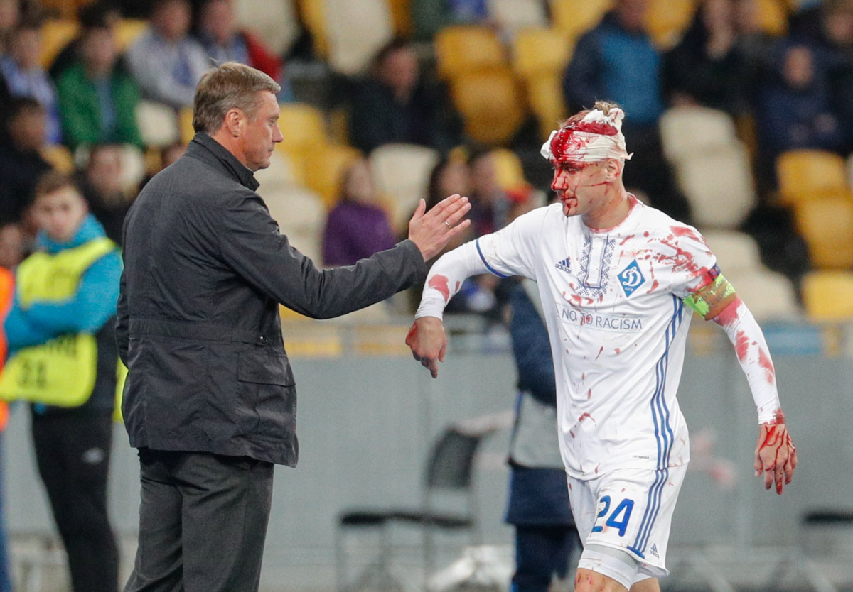 Domagoj Vida dobio 10 šavova na glavi: "Bilo je puno krvi, izgledalo je grozno"
