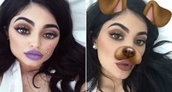 Sve se više ljudi operira da izgledaju poput filtera sa Snapchata, a posljedice mogu biti užasne