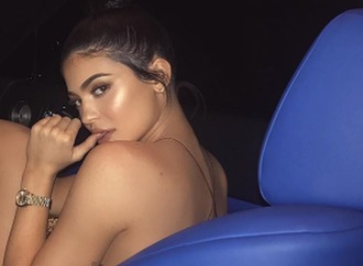 "Rasparala mi je cijelu nogu": Kylie Jenner pokazala ogromni ožiljak