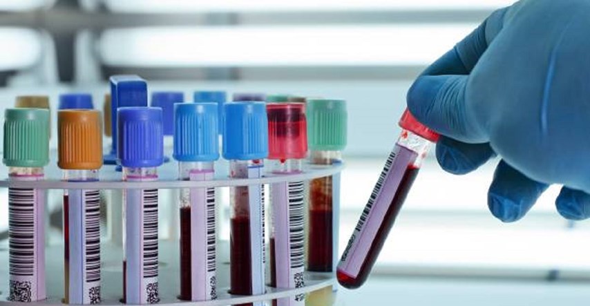 Znanstvenici razvijaju test koji otkriva 50 vrsti raka iz uzorka krvi