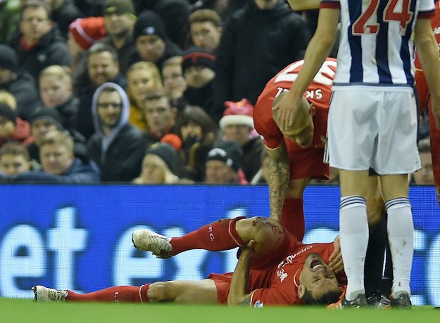 Lovren teško ozlijeđen: Krv mu lipti iz koljena, Anfield ga ispratio pljeskom, suigrači utučeni!