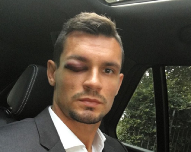 FOTO Užasno izgleda: Pogledajte zatvoreno oko Dejana Lovrena zbog kojeg propušta derbi s prvakom