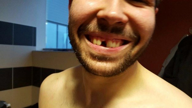 Veszprem prebio zagrebaše: Pogledajte kako izgleda Šebetić nakon bitke u Mađarskoj