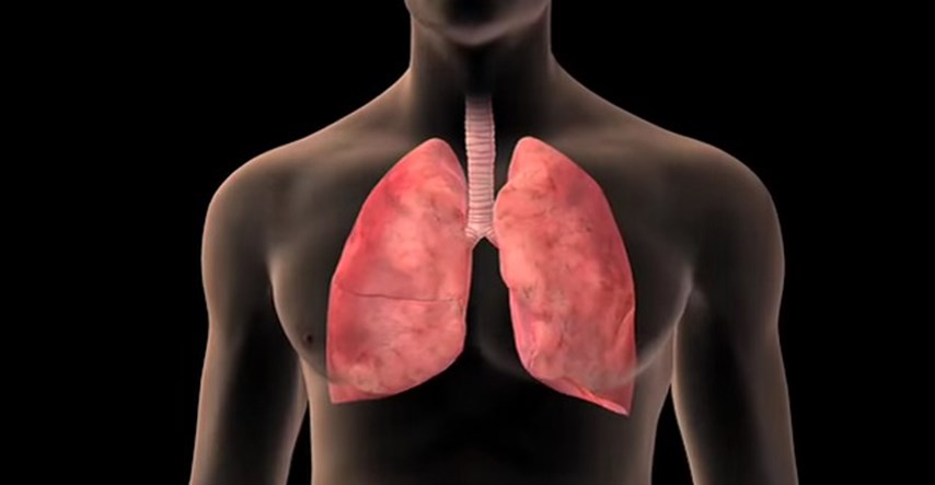 Udruga Jedra: Može li rak pluća postati kronična bolest? Uz ciljanu terapiju može!