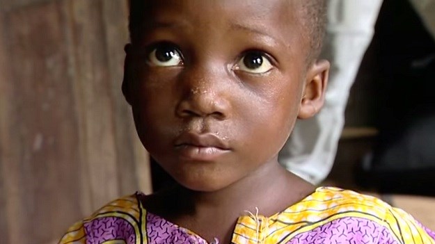 Prvo cjepivo protiv malarije uskoro u Africi?