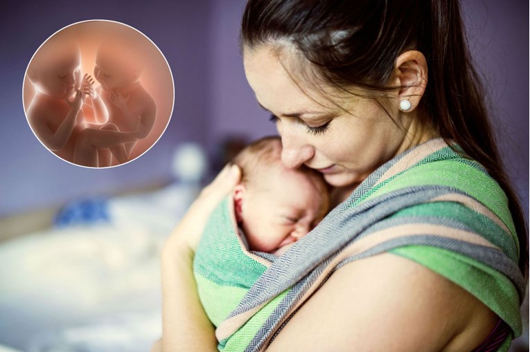 Indijska beba rođena "trudna" sa svojim blizancem, liječnici zaprepašteni