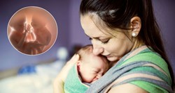 Indijska beba rođena "trudna" sa svojim blizancem, liječnici zaprepašteni