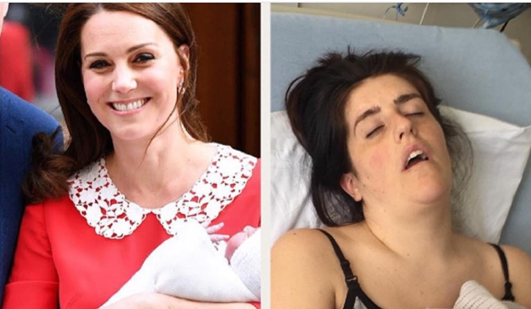 Novi hit na internetu: Mame šalju svoje realne slike nakon poroda i uspoređuju se s Kate Middleton