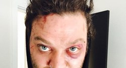 Jackassovac Bam Margera brutalno napadnut na islandskom festivalu