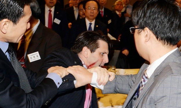 Incident u Seulu: Napadač izrezao lice američkom veleposlaniku