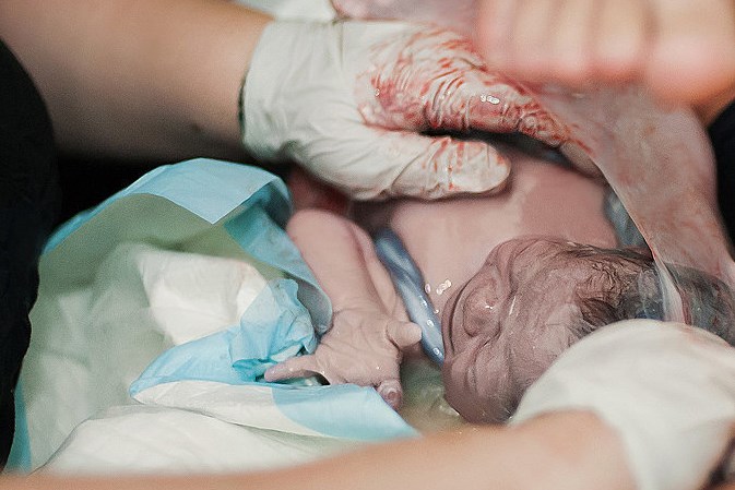 Jeste li ikada vidjeli bebu rođenu u netaknutom vodenjaku?