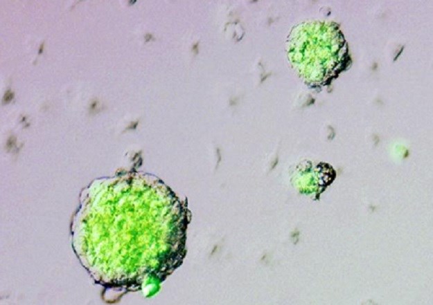 Ovo se smatralo nemogućim: Znanstvenici otkrili mikroorganizam bez mitohondrija