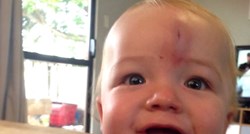 Kada je potrebno dizati paniku ako beba udari glavu?