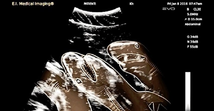 Rendgenske snimke" trudnica": Kako prije rođenja izgledaju bebe životinja?