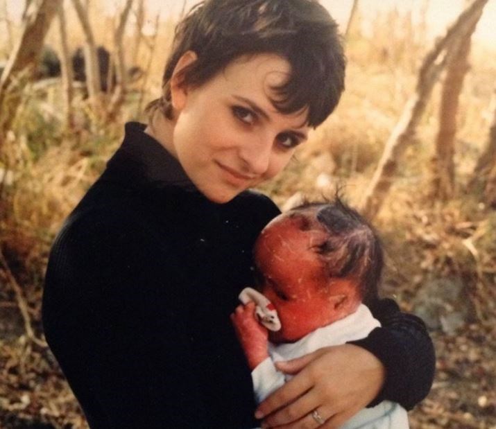 FOTO Majka ju je ostavila prije 23 godine jer se rodila potpuno crvena, evo kako izgleda danas