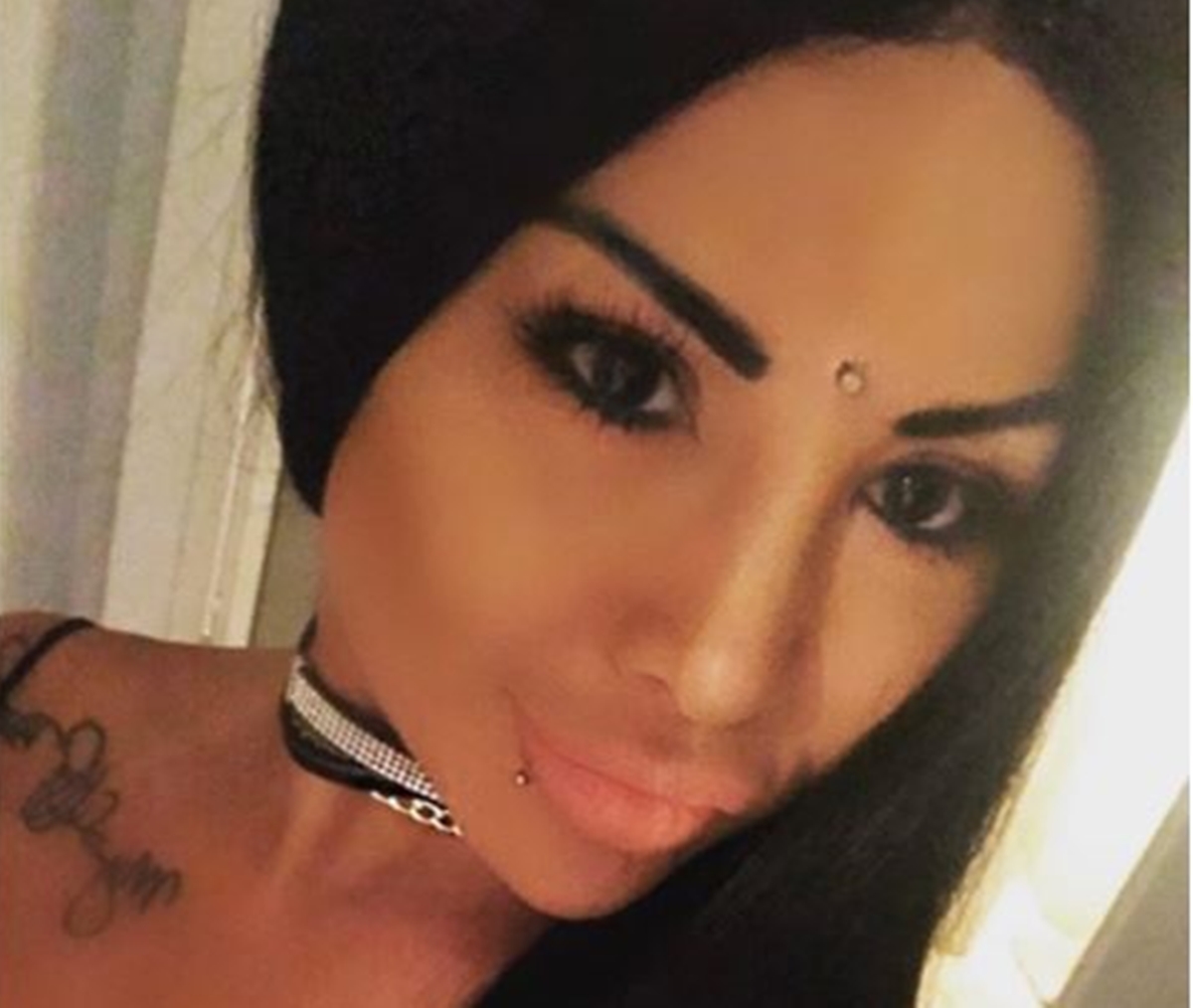 Vlasnica popularne Instagram guze oslijepjela nakon bizarne estetske operacije