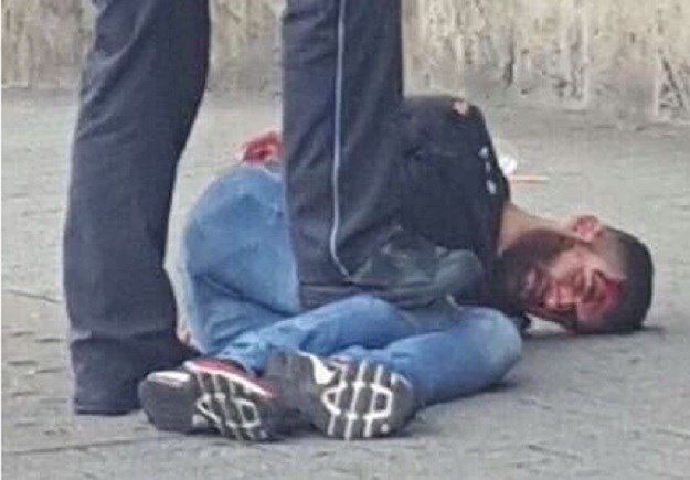 FOTO Lice napadača s mačetom: Građanin ga oborio BMW-om, a policija uhitila