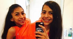 FOTO Sijamske blizanke spojene su 16 godina i unatoč problemima ne žele da ih razdvoje