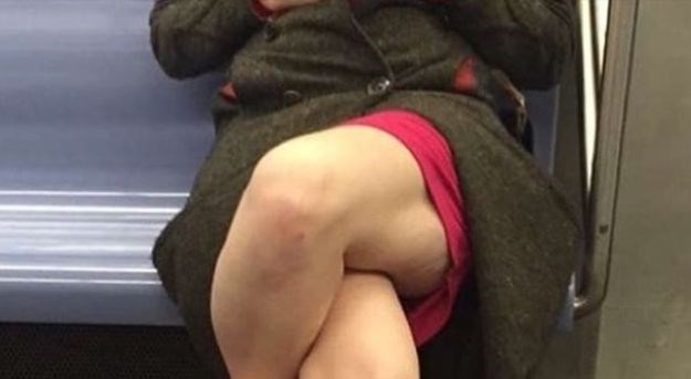 Bizarna fotografija koja je uznemirila pola milijuna ljudi: Što se to događa s nogama ove žene?