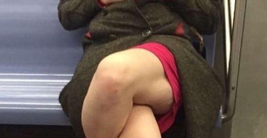 Bizarna fotografija koja je uznemirila pola milijuna ljudi: Što se to događa s nogama ove žene?