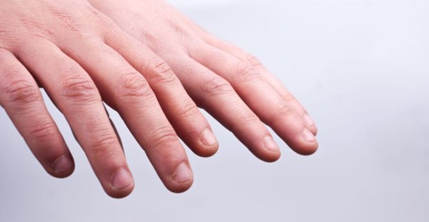 Liječnici otkrili što se događa tijelu kad grizete nokte. Nije dobro.