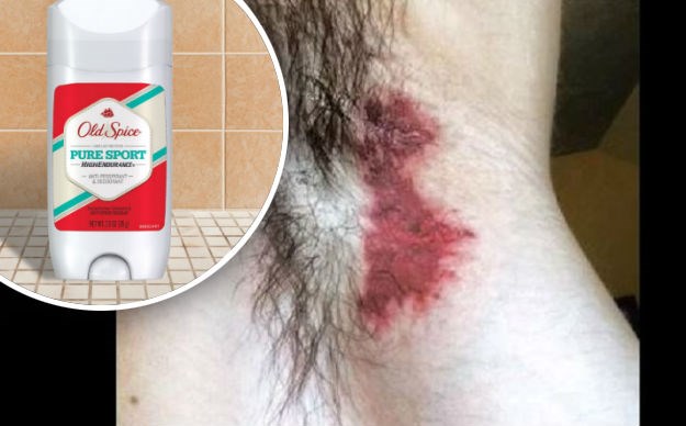 Muškarci u panici: Old Spice im spalio pazuhe