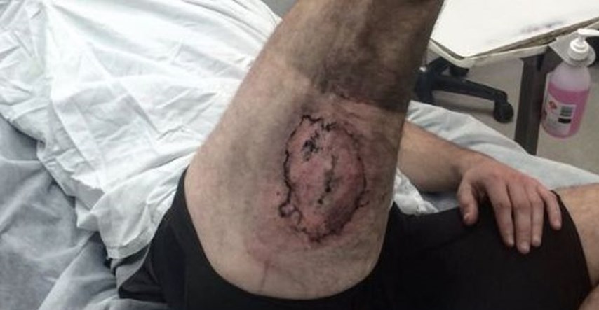 FOTO Završio u bolnici: Pogledajte kakve užasne ozljede vam može nanijeti iPhone