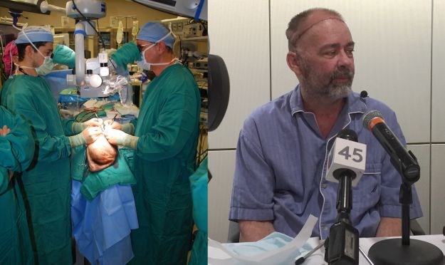 Liječnici prvi put izvršili transplantaciju lubanje i vlasišta