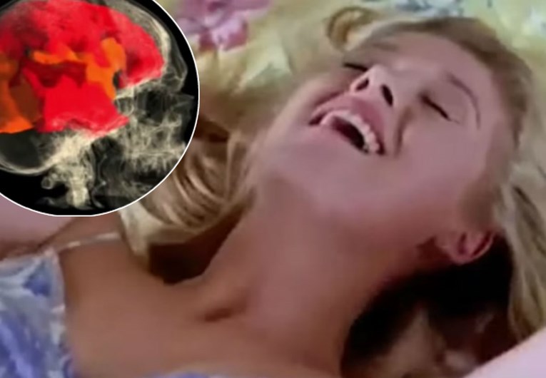 VIDEO Snimali su žene dok su masturbirale i otkrili kako izgleda mozak tijekom orgazma