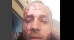 AKCIJA U VENEZUELI Policija lovi pilota koji je napao vladine zgrade, on se javio na Instagramu: "Ubijaju nas"