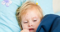 Istraživanje imunologa s Princetona: Cijepljenje protiv ospica štiti i od drugih bolesti