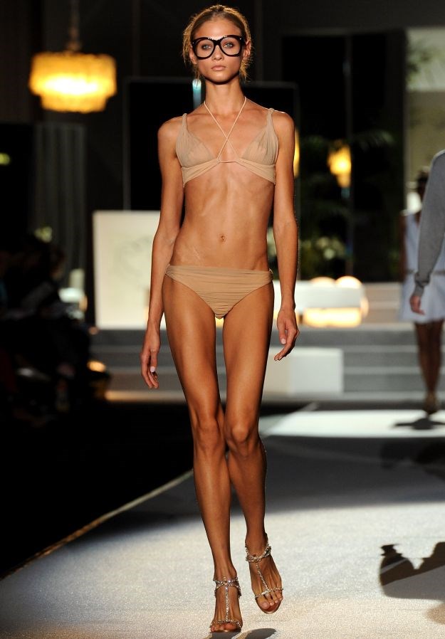 I Francuzi se bore protiv anoreksije, zabranili premršave manekenke