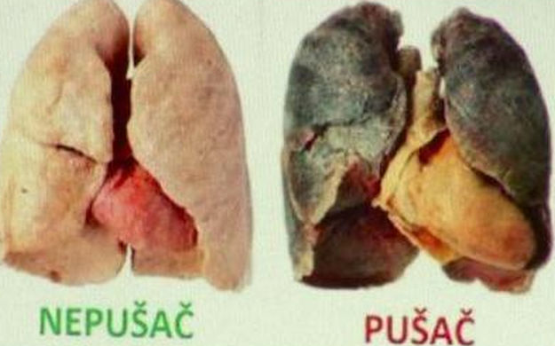 Šokantne fotografije uskoro na cigaretama, liječnici predlažu i kazne za nepridržavanje uputa