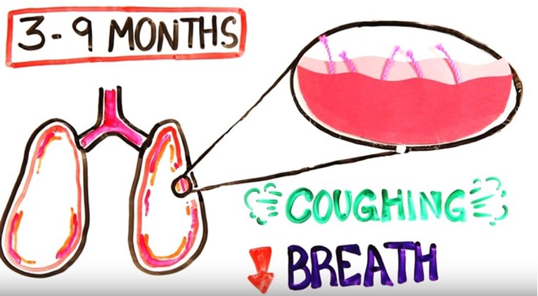 VIDEO Evo što se događa u vašem tijelu kada prestanete pušiti
